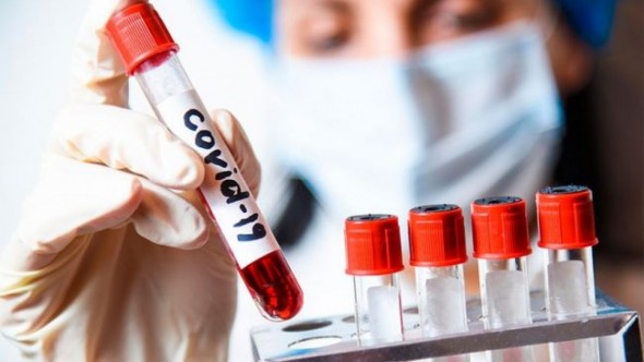 DOC // La câteva ore după ce au aprobat codul roșu din cauza Covid-19, autoritățile din Rîșcani l-au anulat